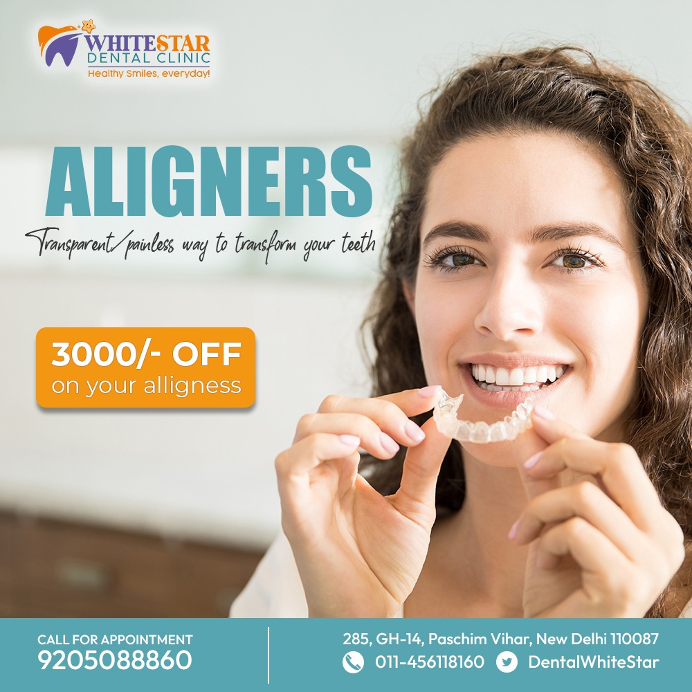 Aligner Braces cost in Paschim Vihar