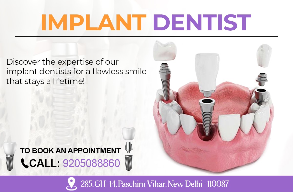 implant dentist in paschim vihar