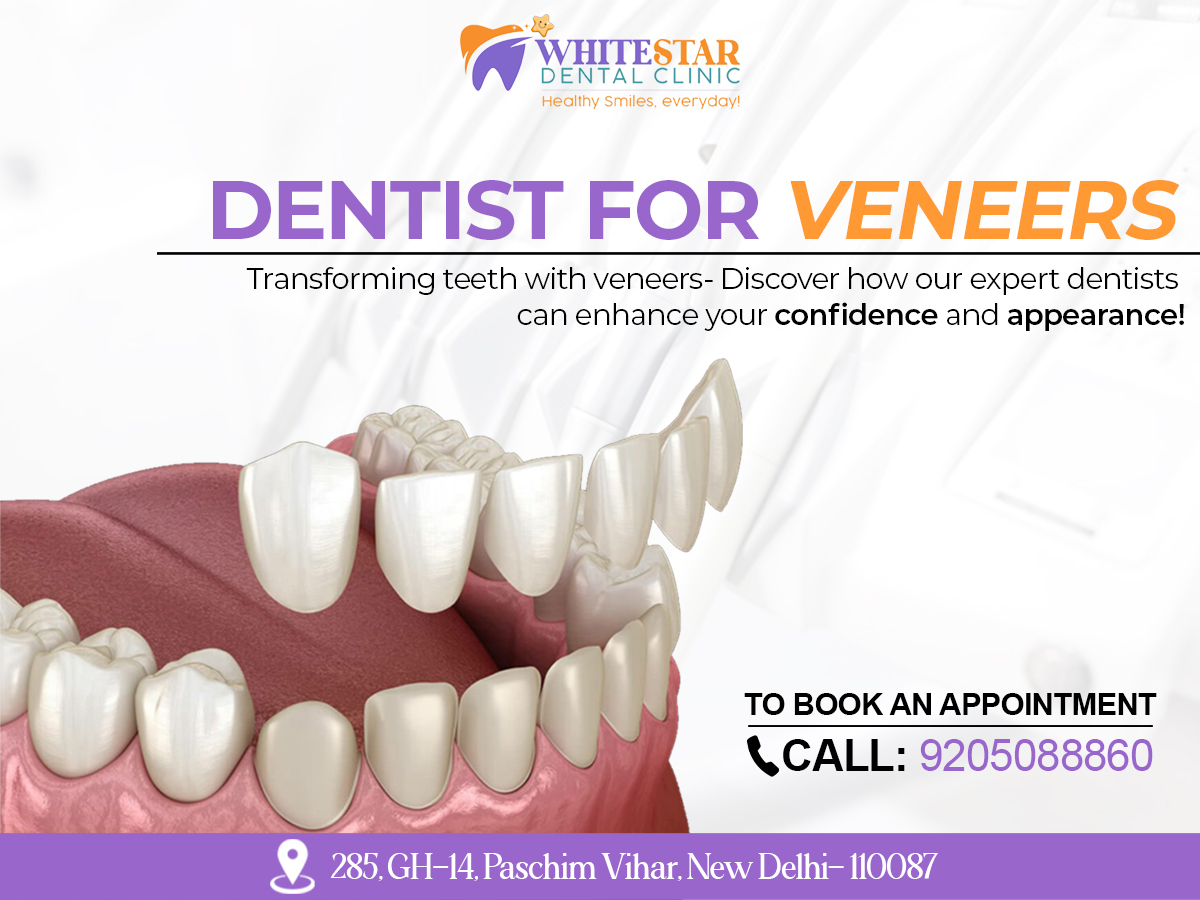 Porcelain veneers cost paschim vihar