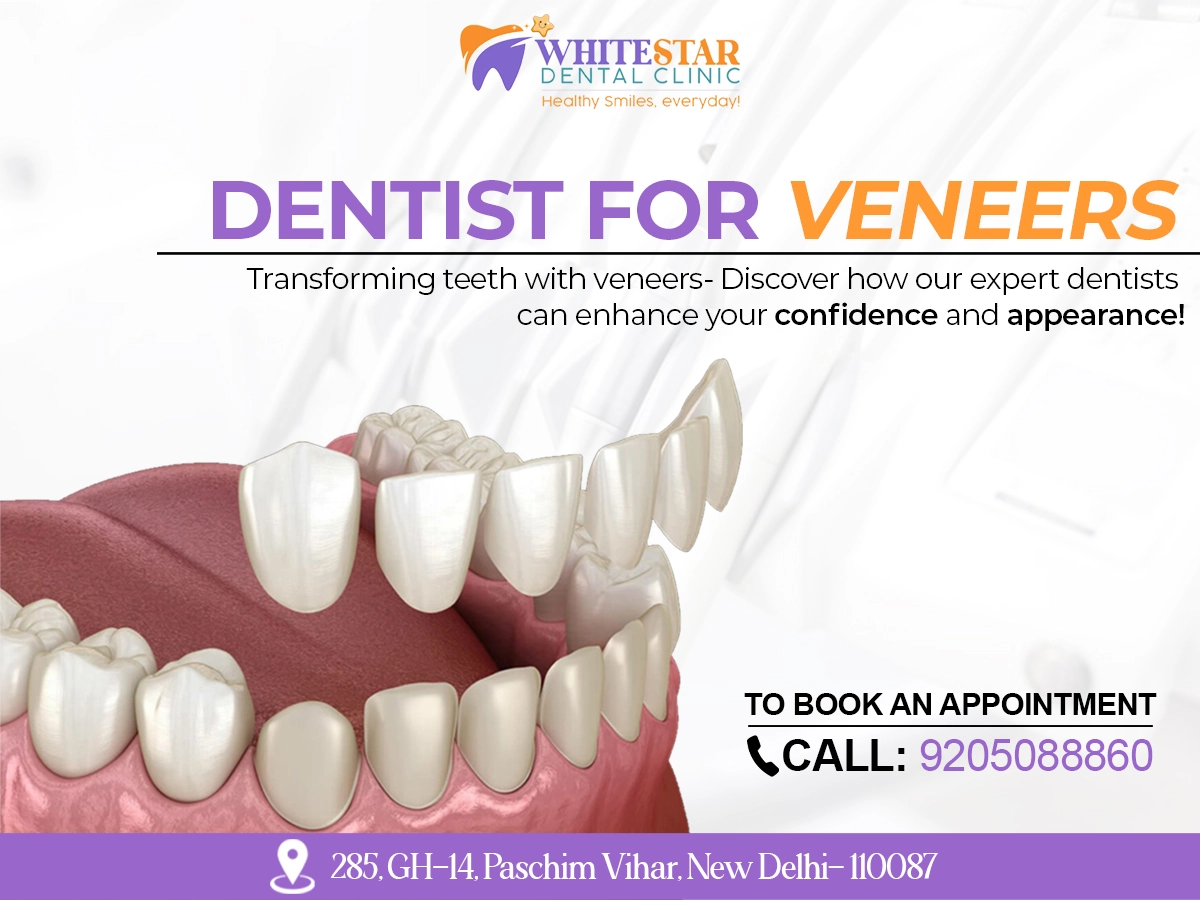 Dentist for veneers paschim vihar