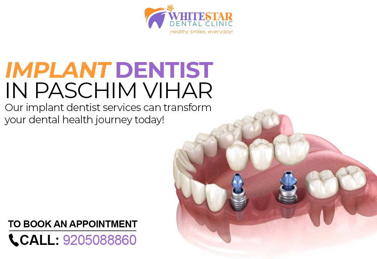 Dental Implants Clinic in Paschim Vihar